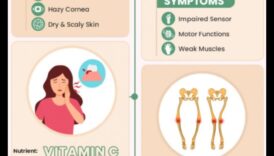 الفجوات الغذائية: نظرة فاحصة على قضايا النقص الشائعة
